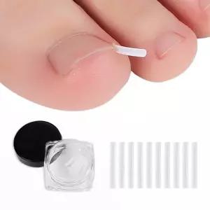 와이어 내성 교정 밴드 관리 내향성 발톱 기획전 인기제품 10p 팁