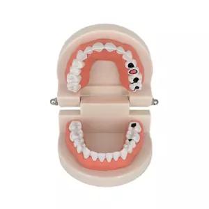 초중고 보건교육 과학실 인체기관 구강구조 수업용 치아 충치모형 1:1 학교