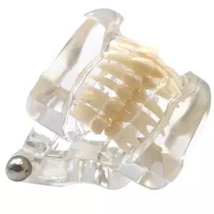 치과 스케일링 덴티폼 치아 구조 구강 충지 모형