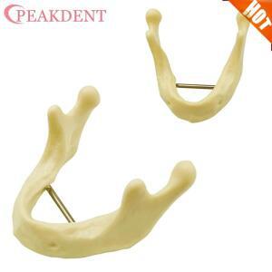 치과 임플란트 모델 하악 뼈 시뮬레이션 학습 실습