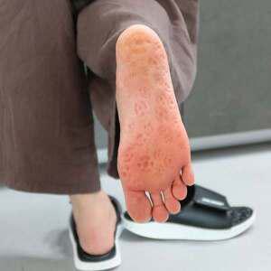 [다이어트학교]부끼톡스 리압슬리퍼 다이어트 붓기 지압슬리퍼 사무실슬리퍼