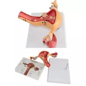산부인과 자궁 질환 여성 생식기 모형 인체피규어