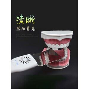 구내 촬영용 미러 세트 김서림 4개 방지 거울 교정용 가벼운 A 손잡이