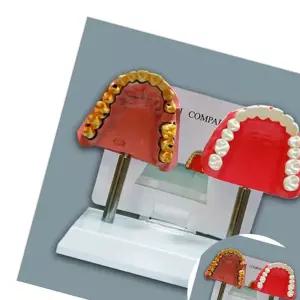 금연교육 (30135) 흡연자 치아 비교모형