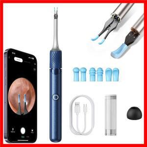 스마트 비주얼 귀이개 내시경 핀셋 카메라 내장 귀청소기 1200만 화소 귀지 제거