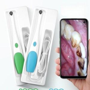 구강 내시경 카메라 고화질 자동차 디스플레이 전용 ㅣ200배율 200만 현미경 치경 이빨
