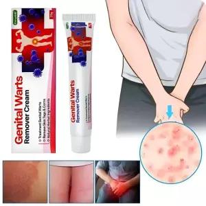 곤지름 연고 남자 생식기 사마귀 치료 콘딜로마 매독 헤르페스 제거 치료제 20g
