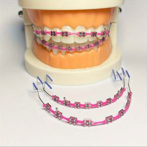 금속 체인이 포함된 1쌍의 패셔너블한 치아 장식 세트 - 상/하 치아 매칭을 위한 업그레이드된 치과 모델 키트, 일상 파티 착용
