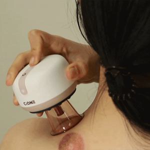 시오네 원터치 전동식 스마트 무선 온열 찜질 부항기 + 부항컵 세트 가정용 의료기기