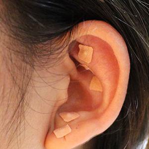 귀침 스티커 600개 혈자리 귀지압 패치 이혈 테라피