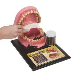 [HEALTH EDCO] 흡연자의 구강모형 대형 Giant Gross Mouth M79159KO