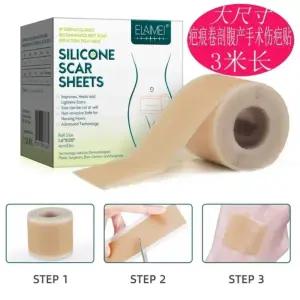 제왕절개밴드 4x300cm 실리콘 테이프