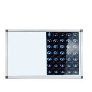 LED 뷰박스 엑스레이 반사판 필름 의료용 판독 뷰어 정형외과 관람등 전용