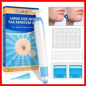 대형 피부 태그 제거 키트 (4-9mm 대형 피부 태그용) 클렌징 스왑 포함 가정용 얼굴 피부 관리 도구