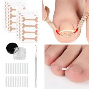 페어토 내성발톱 교정기 테이프 밴드 셀프케어