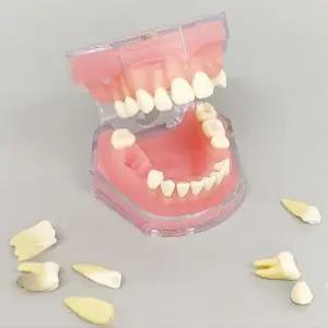 치위생 치아모형 덴티폼 스케일링 구강 실습 소품