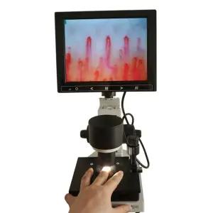 모니터 모세 혈관 현미경 디지털 화면 고화질 분석기 돋보기