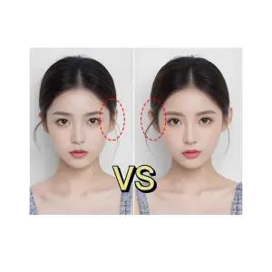 [에스에스_62]패치 세우는 테이프 엘프 귀 귀세우는테이프