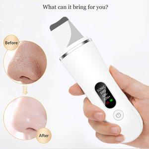 새로운 초음파 스크러버 블랙 캐비테이션 제거 클렌징 필링 얼굴