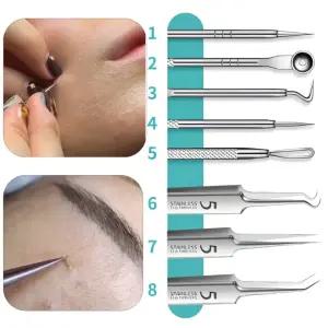 뾰루지 관리용품 피지제거 모공청소 여드름관리 8종세트