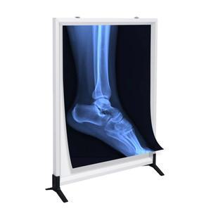 엑스레이 대 뷰박스 라이트 기 LED 산업용 조명 단일링크