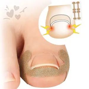 발톱 내성 발톱 교정 보호 테이프 밴드 시트 발 관리 용품 발톱 보호 교정 케어