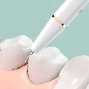 초음파 전동 치석제거기 화이트 셀프 스케일링 흡연 변색 미백 구취제거 구강세정기 P392