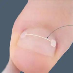 내성 발톱 포도 스트립 교정기 와이어 테이프 내성발톱 밴드