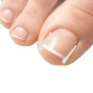 발톱 교정 보호 테이프 10p 내향성 발톱 관리 풋케어 압박 완화 실리콘 패드