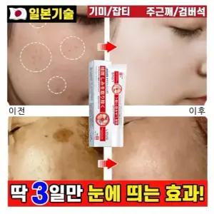 [일본피부과 전용] 기미크림 기미·잡티·주근깨·검버섯 완화 크림 / 멜라닌 생성억해 / 색소침착 집중 케어 / 저자극 톤업