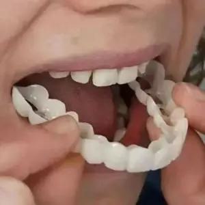 교정 마우스피스 빠진이 앞니 이빨 틀니 치열 누런 턱교정장치 세트 치과 보호 이갈이 치아