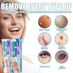 Jaysuing 질환연고 질환항균제거 스킨케어 밤 얼굴과 목 겨드랑이 바깥쪽 바디케어 밤