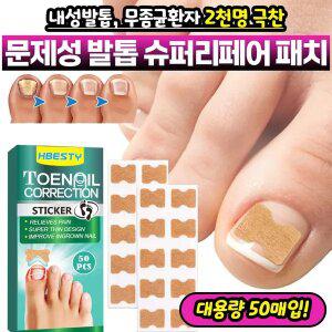 내성발톱무좀균환자 2천명 극찬 문제성 발톱 슈퍼리페어 패치
