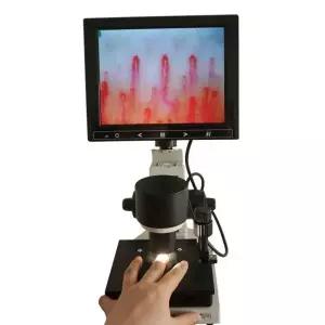 모세혈관 확대경 모니터 전자 현미경 생물 7인치 고배율