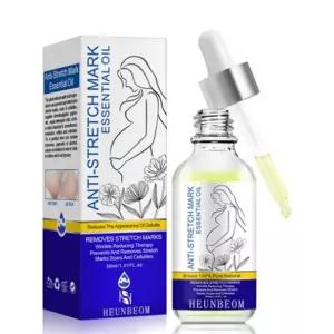 출산후 튼살 크림 오일 오래된 흰색 붉은 튼살 제거