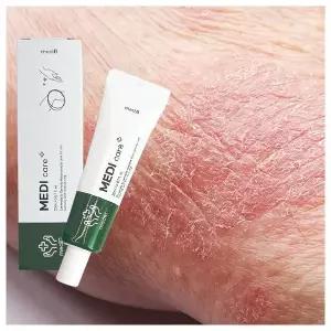 피부개선 건조한 피부 가려움증 간지러움 땀띠 습진 연고 크림