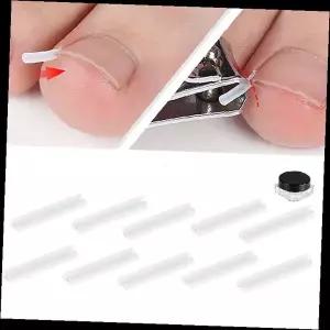 발톱교정기 내성발톱 치료용품 투명밴드 와이어형 가정용 발관리도구 셀프케어