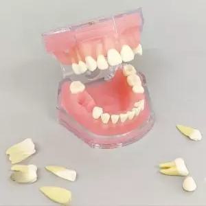 치위생 치아모형 덴티폼 스케일링 구강 실습 소품
