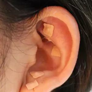 지압패치 귀혈자리 하루혈자리  경락 붙이는 자극 패치 600개