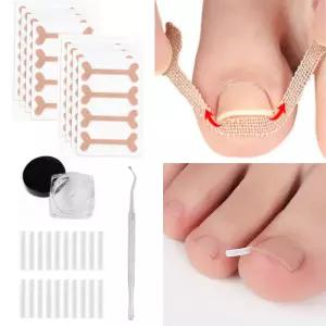 페어토 내성발톱 교정기 테이프 밴드 셀프케어