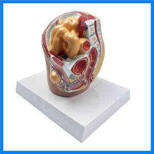 인간 사타구니 탈장 병리 피부 모델, 의료 교육 모델