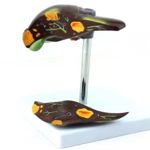 의학 모형 B형 간염 교육용 간경변 해부학 실습 지방간 간질환 교구