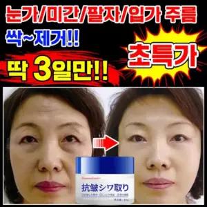 [100% 효과있음][기미/잡티/검버섯/흑자 제거크림 1위] 비타민C 트라넥삼산 멜라논 미백 크림기미 잡티 주근깨 미백 색소침착 착색 검버섯 수분 보습 화이트닝 광채 