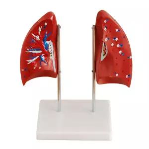 폐 모형 인체 교육용 모델 실습용 해부학 과학 호흡기관 병원 해부 허파 장기 교육