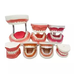 치아모형 구강 이모형 디스플레이 인체  교육용