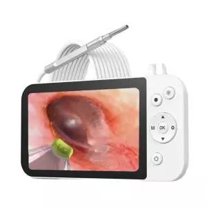 셀프 연결 귀이개 제거 검이경 귀지 귀청소 내시경 카메라