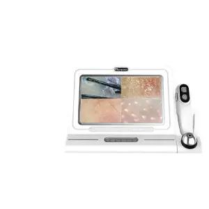 미용실 진단기 두피 11인치 피부관리실 현미경 헤어케어 확대경 고화질