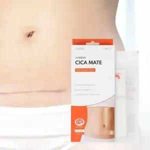 시카메이트 15x3cm 시카케어 실리콘 겔 시트 제왕절개 흉터밴드 켈로이드 흉터관리