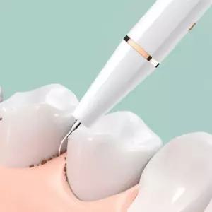 초음파 전동 치석제거기 화이트 셀프 스케일링 흡연 변색 미백 구취제거 구강세정기 P392