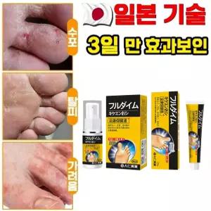 발 관리 크림/스프레이 20g 2개/30ml 2개